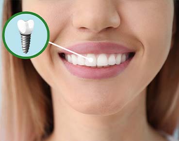 Routine Dental Exam and Cleaning at Santa Monica Tooth Doctor